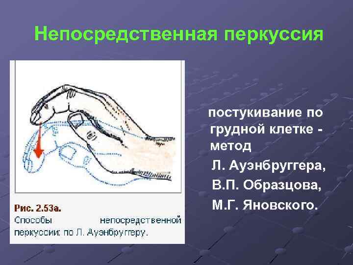 Непосредственная перкуссия постукивание по грудной клетке метод Л. Ауэнбруггера, В. П. Образцова, М. Г.