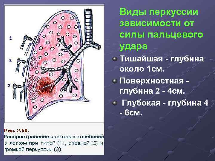 Виды перкуссии зависимости от силы пальцевого удара Тишайшая - глубина около 1 см. Поверхностная