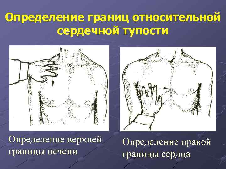 Определение границ относительной сердечной тупости Определение верхней границы печени Определение правой границы сердца 