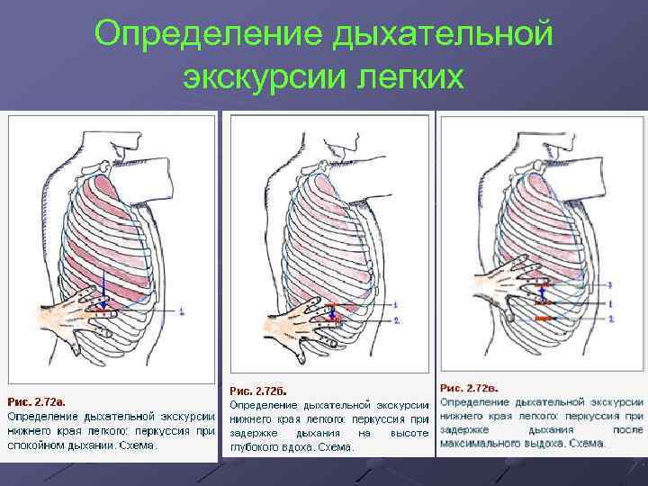 Определение дыхательной экскурсии легких 