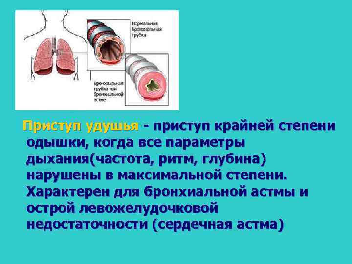 Приступ удушья приступ крайней степени одышки, когда все параметры дыхания(частота, ритм, глубина) нарушены в