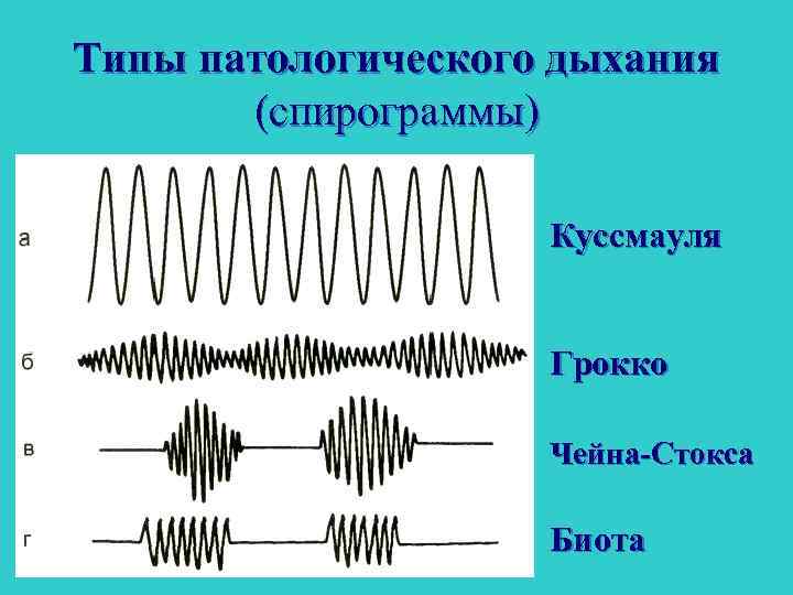 Патологическое дыхание это. Типы дыхания Биота чейн Стокса патологические Куссмауля. Дыхание Куссмауля дыхание Чейна-Стокса дыхание Биота. Патологические типы дыхания чейн Стокса.