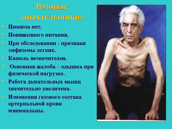 Розовые «пыхтельщики» • Цианоза нет. • Пониженного питания. • При обследовании признаки • •