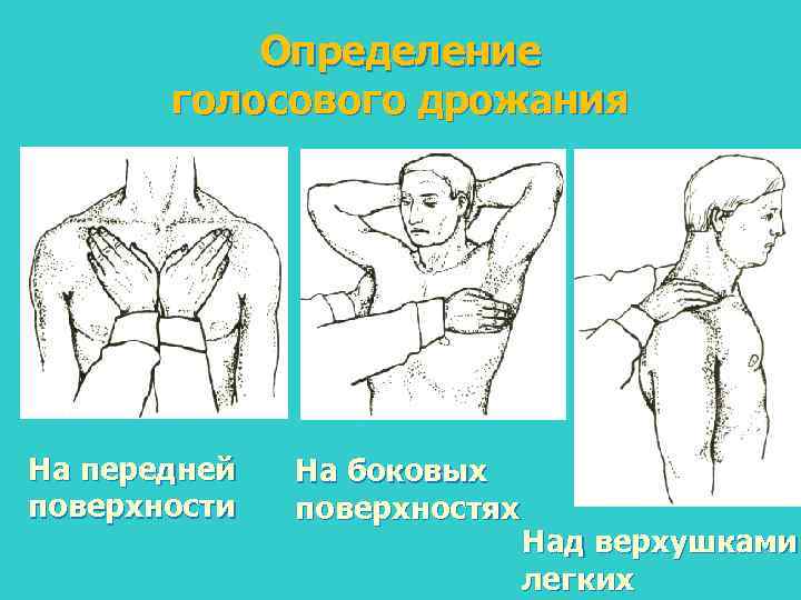 Определение голосового дрожания На передней поверхности На боковых поверхностях Над верхушками легких 