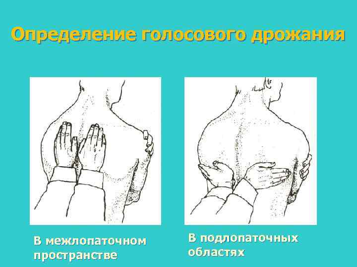 Определение голосового дрожания В межлопаточном пространстве В подлопаточных областях 