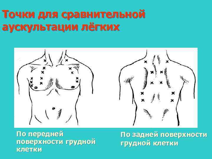 Аускультация легких картинки