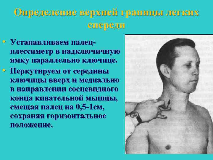 Определение верхней границы легких спереди • Устанавливаем палец • плессиметр в надключичную ямку параллельно