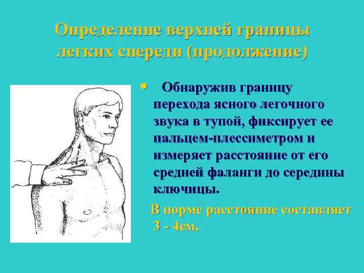 Определение верхней границы легких спереди (продолжение) • Обнаружив границу перехода ясного легочного звука в