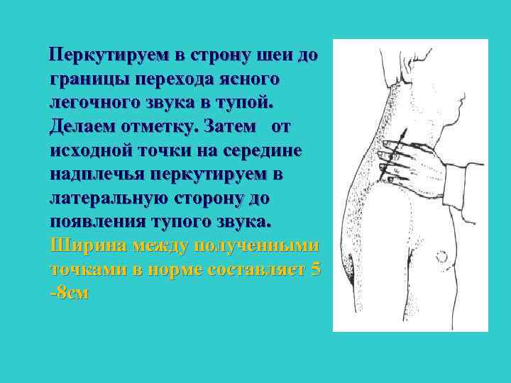 Перкутируем в строну шеи до границы перехода ясного легочного звука в тупой. Делаем отметку.