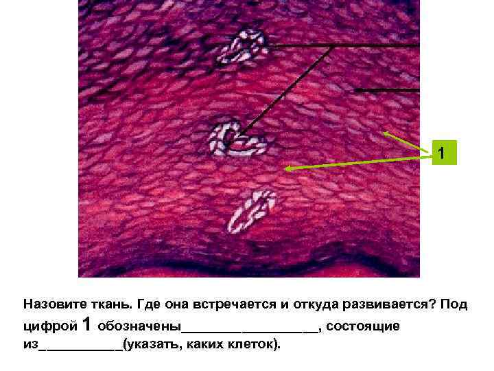 1 Назовите ткань. Где она встречается и откуда развивается? Под цифрой 1 обозначены_________, состоящие