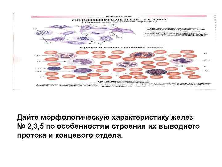 Дайте морфологическую характеристику желез № 2, 3, 5 по особенностям строения их выводного протока