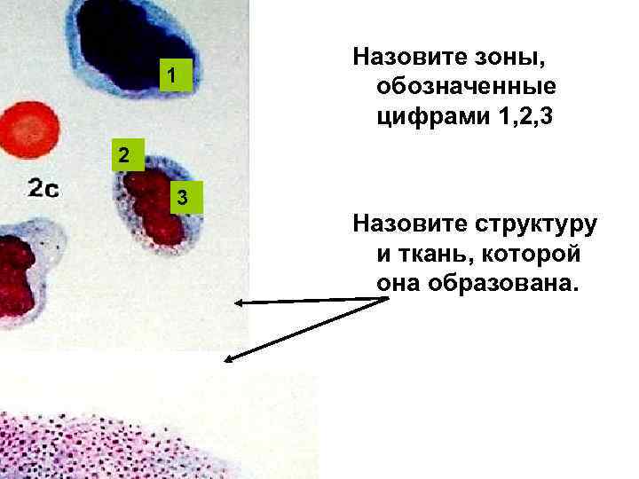 1 Назовите зоны, обозначенные цифрами 1, 2, 3 2 3 Назовите структуру и ткань,