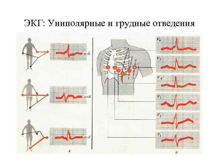 ЭКГ: Униполярные и грудные отведения 