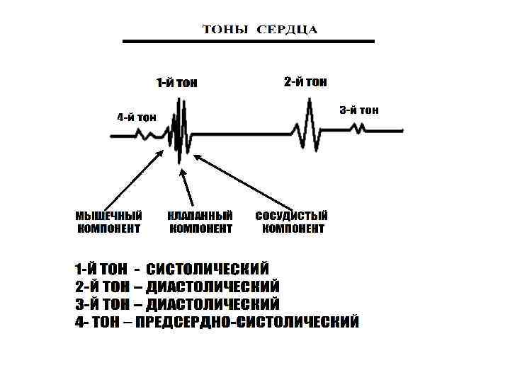 Тоны сердца картинки