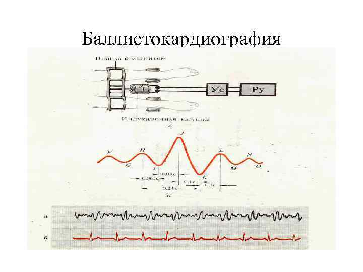 Баллистокардиография 