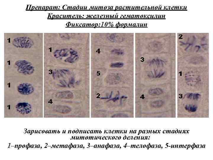 Препарат: Стадии митоза растительной клетки Краситель: железный гематоксилин Фиксатор: 10% формалин Зарисовать и подписать