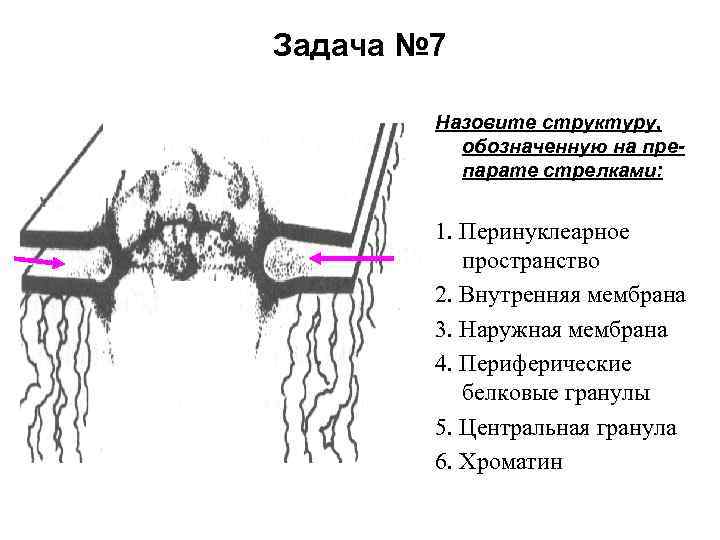 Задача № 7 Назовите структуру, обозначенную на препарате стрелками: 1. Перинуклеарное пространство 2. Внутренняя