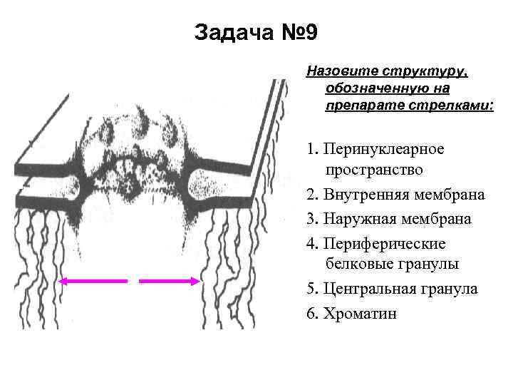 Задача № 9 Назовите структуру, обозначенную на препарате стрелками: 1. Перинуклеарное пространство 2. Внутренняя