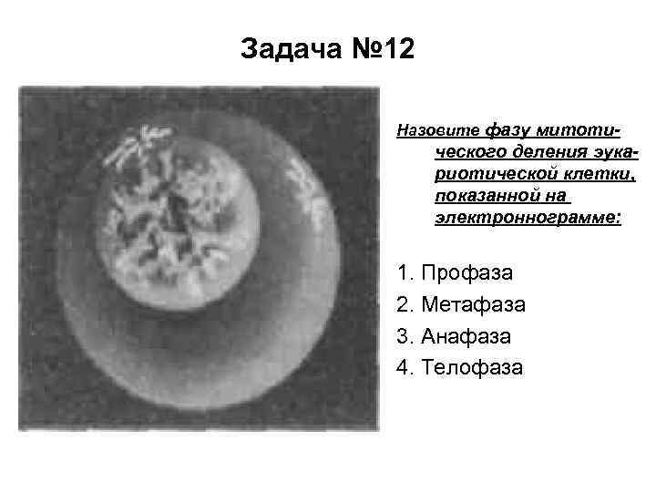 Задача № 12 Назовите фазу митоти- ческого деления эукариотической клетки, показанной на электроннограмме: 1.