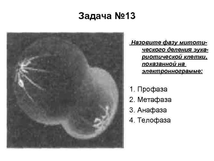 Задача № 13 Назовите фазу митотического деления эукариотической клетки, показанной на электроннограмме: 1. Профаза