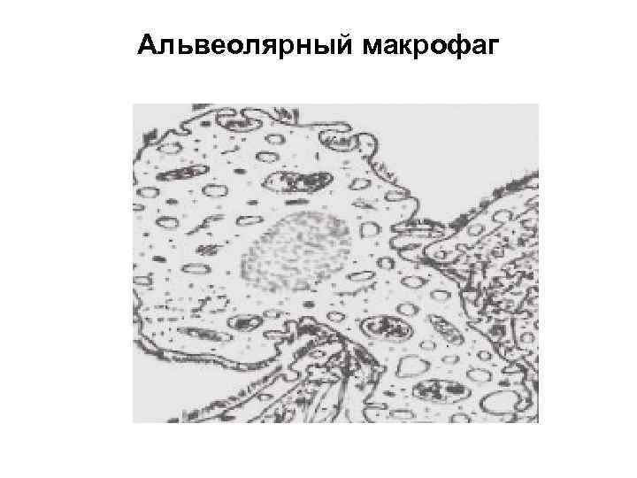 Альвеолярный макрофаг 