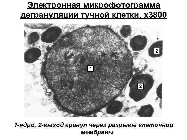 Электронная микрофотограмма дегрануляции тучной клетки, х3800 2 1 -ядро, 2 -выход гранул через разрывы