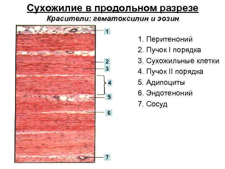 Сухожилия ткань