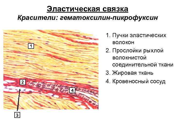 Эластические волокна в мокроте фото