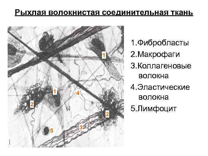 Рыхлая волокнистая соединительная ткань 1 1 4 2 2 5 3 1. Фибробласты 2.