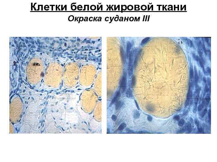 Клетки белой жировой ткани Окраска суданом III 