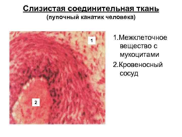 Слизистая соединительная ткань (пупочный канатик человека) 1 2 1. Межклеточное вещество с мукоцитами 2.