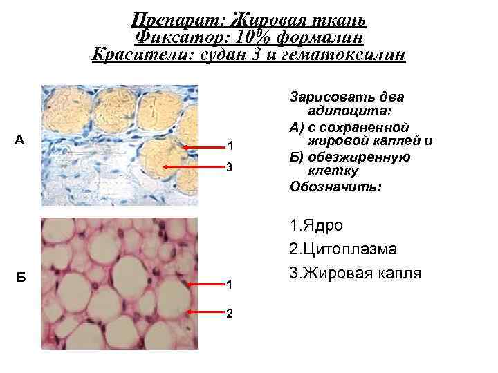 Препарат: Жировая ткань Фиксатор: 10% формалин Красители: судан 3 и гематоксилин А 1 3