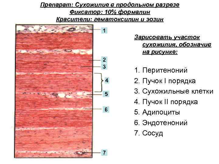 Препарат: Сухожилие в продольном разрезе Фиксатор: 10% формалин Красители: гематоксилин и эозин 1 Зарисовать