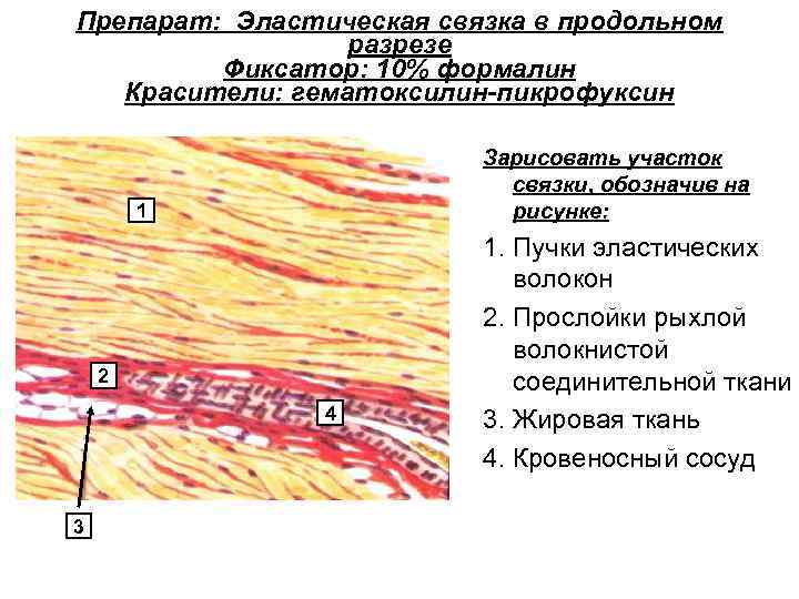 Препарат: Эластическая связка в продольном разрезе Фиксатор: 10% формалин Красители: гематоксилин-пикрофуксин Зарисовать участок связки,