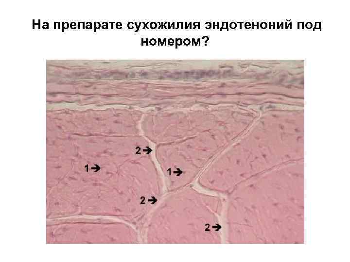 На препарате сухожилия эндотеноний под номером? 