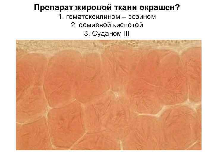 Препарат жировой ткани окрашен? 1. гематоксилином – эозином 2. осмиевой кислотой 3. Суданом III