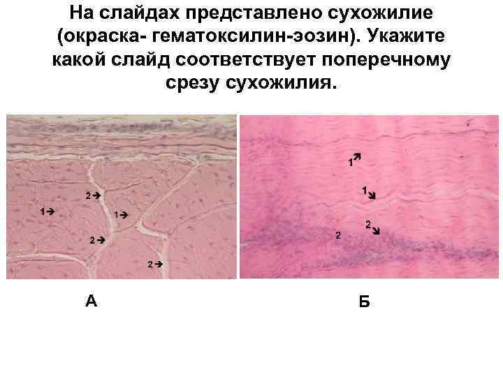 На слайдах представлено сухожилие (окраска- гематоксилин-эозин). Укажите какой слайд соответствует поперечному срезу сухожилия. А