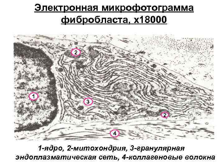 Электронная микрофотограмма фибробласта, х18000 2 1 3 2 4 1 -ядро, 2 -митохондрия, 3