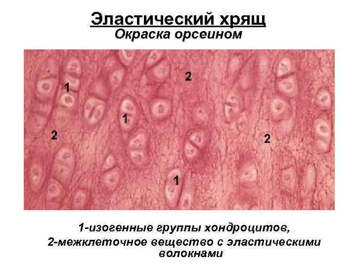 Эластический хрящ Окраска орсеином 1 -изогенные группы хондроцитов, 2 -межклеточное вещество с эластическими волокнами