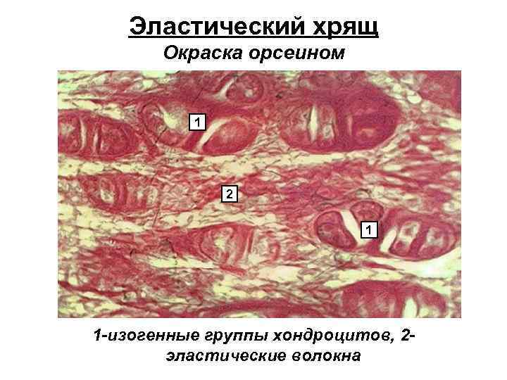 Эластический хрящ Окраска орсеином 1 2 1 1 -изогенные группы хондроцитов, 2 эластические волокна