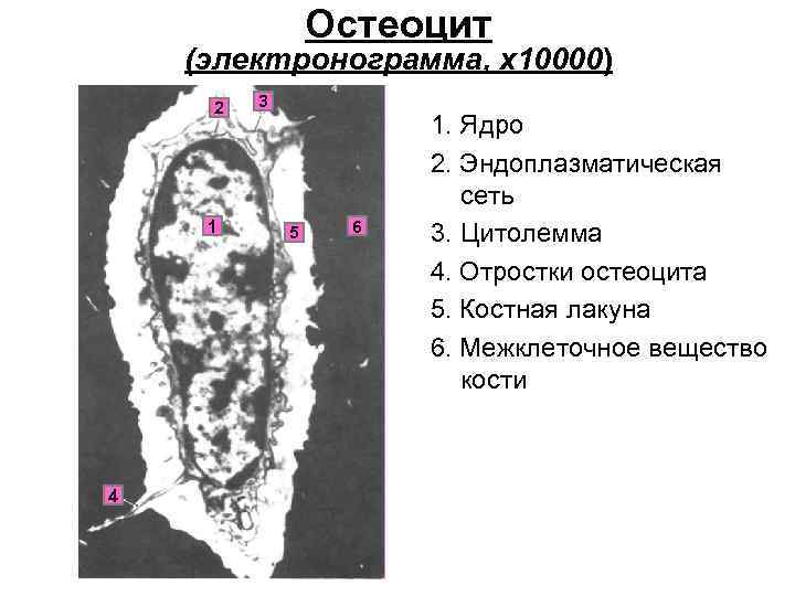 Остеоцит (электронограмма, х10000) 2 1 4 3 5 6 1. Ядро 2. Эндоплазматическая сеть