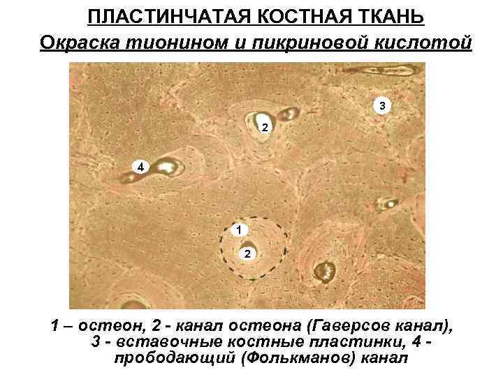 ПЛАСТИНЧАТАЯ КОСТНАЯ ТКАНЬ Окраска тионином и пикриновой кислотой 3 2 4 1 2 1