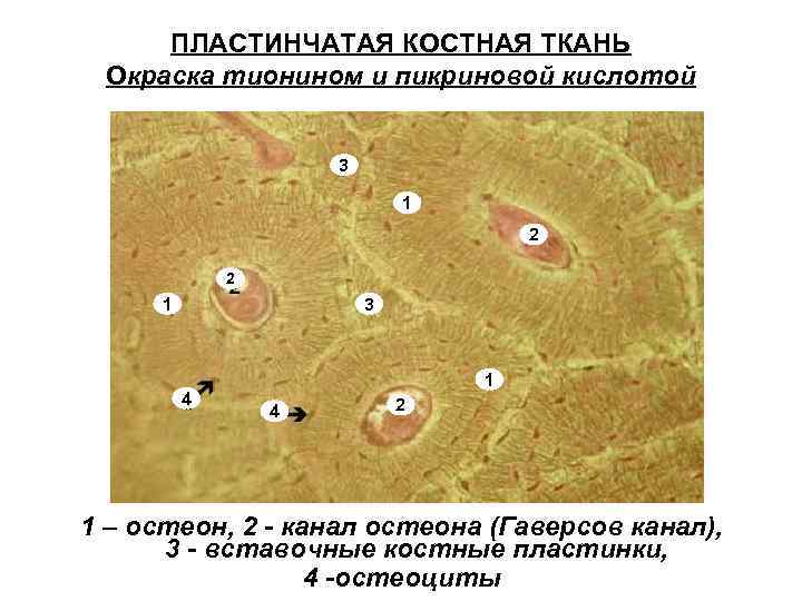 ПЛАСТИНЧАТАЯ КОСТНАЯ ТКАНЬ Окраска тионином и пикриновой кислотой 3 1 2 2 1 3