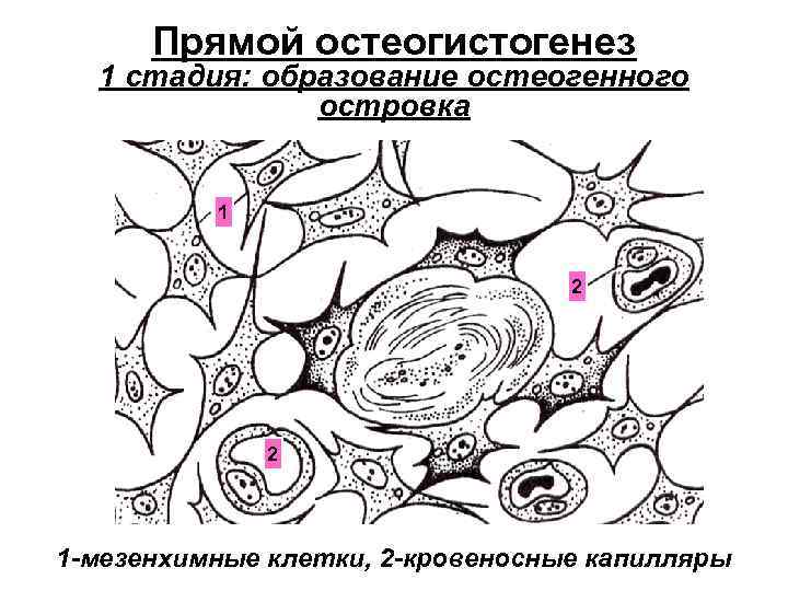 Прямой остеогистогенез 1 стадия: образование остеогенного островка 1 2 2 1 -мезенхимные клетки, 2