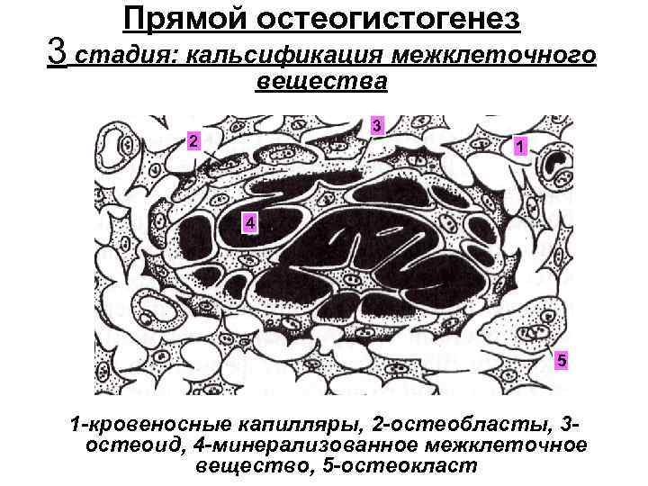 Прямой остеогистогенез 3 стадия: кальсификация межклеточного вещества 3 2 1 4 5 1 -кровеносные