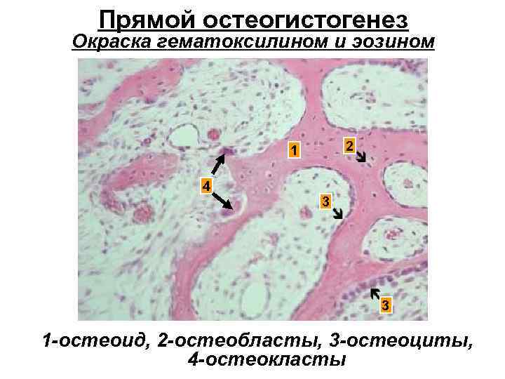 Прямой остеогистогенез Окраска гематоксилином и эозином 2 1 4 3 3 1 -остеоид, 2