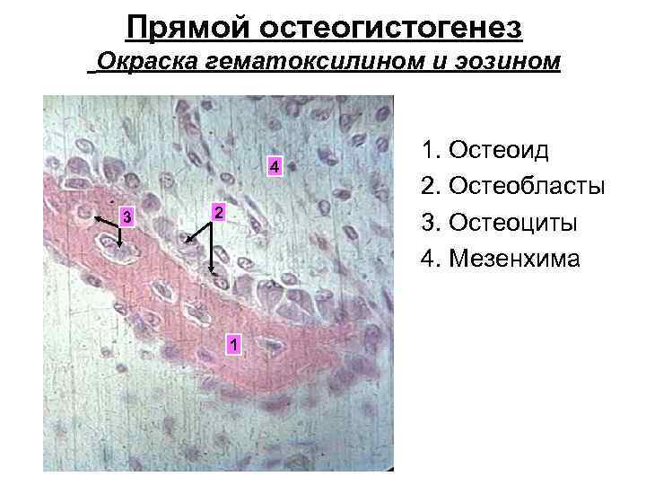 Прямой остеогистогенез Окраска гематоксилином и эозином 4 3 2 1 1. Остеоид 2. Остеобласты