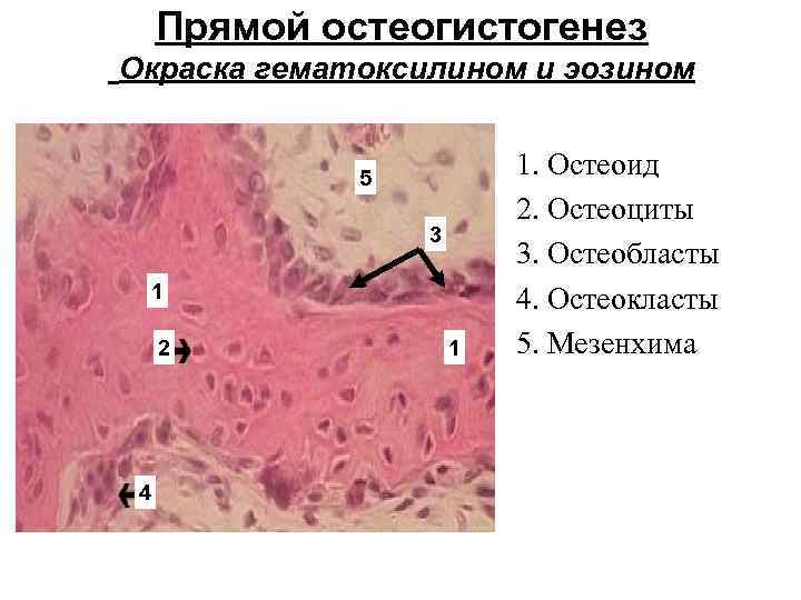 Прямой остеогистогенез Окраска гематоксилином и эозином 5 3 1 2 4 1 1. Остеоид