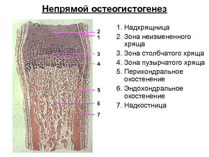 Непрямой остеогистогенез 2 1 3 4 5 6 7 1. Надхрящница 2. Зона неизмененного