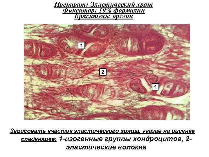 Препарат: Эластический хрящ Фиксатор: 10% формалин Краситель: орсеин 1 2 1 Зарисовать участок эластического